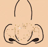 ͷϷ 