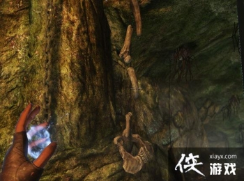 �Ϲž���5����ǹ�ͷ��Ѩ��ϸ�ڡ���������˹��ά������Ѫ���Ĺ�ϵ