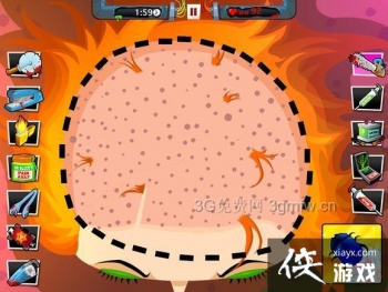 ������ҽ��4��37����ô����Amateur Surgeon 4��37�ع���