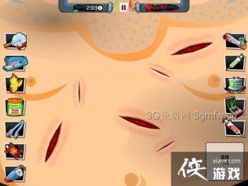 ������ҽ��4��36����ô����Amateur Surgeon 4��36�ع���