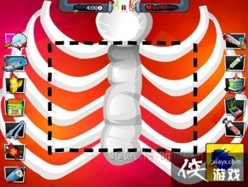 ������ҽ��4��9����ô����Amateur Surgeon 4��9�ع���