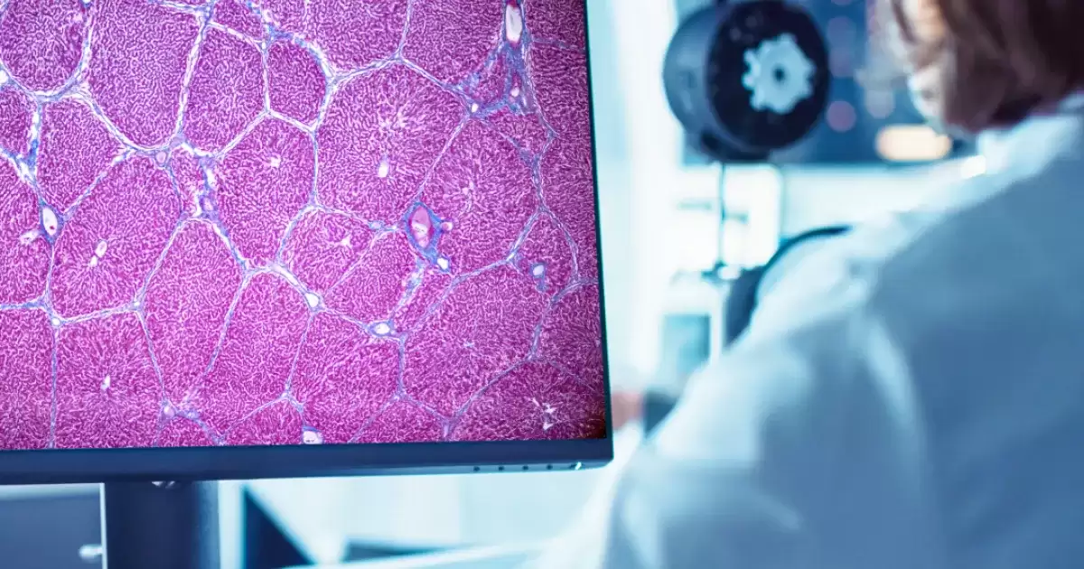 ���� FDA ��׼�׿��˹�����ҩ���з����ߣ�����֬�����ٴ���������