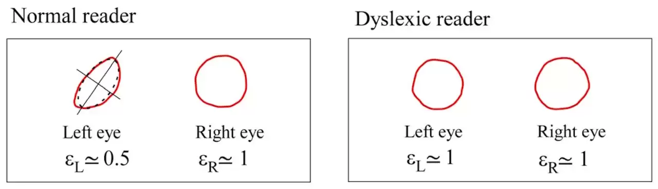 Abeye �Ƴ� Lexilens 23.8 Ӣ����ʾ����רΪ�Ķ��ϰ���ʿ��ƣ�1080P ��144Hz