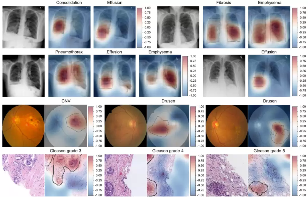 �� AI �Լ��Ҳ������ҽ����ǰ��ע���ҹ���ѧ����ͻ��