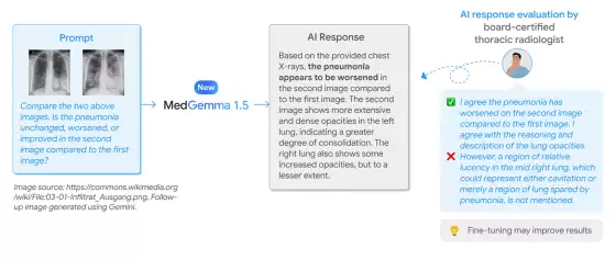 �ȸ跢��ҽ�� AI ģ�� MedGemma 1.5 4B���ɱ��ز���CT��MRI ���ܴ���