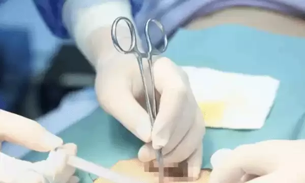 ��������20������ѽ䣬���ͽ��оƬֲ������Ч