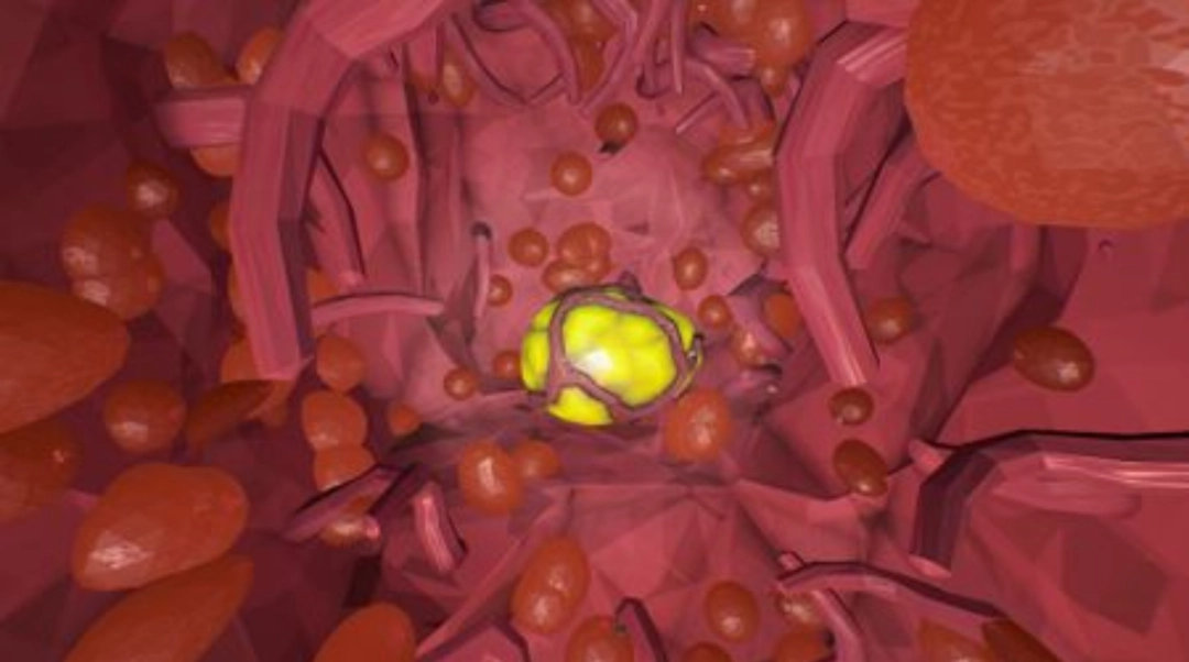 ���������ӡ��浰���ü�λ�÷���