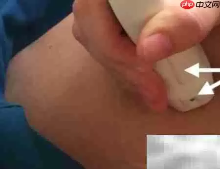 超声探头使用指南 超声探头使用指南