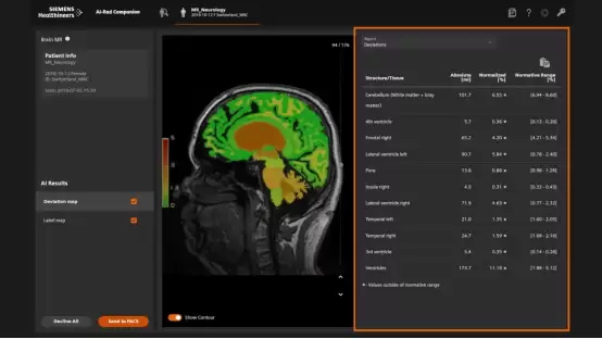 ��700λ�ͻ�������������Ӣ�ض�Vision 2025