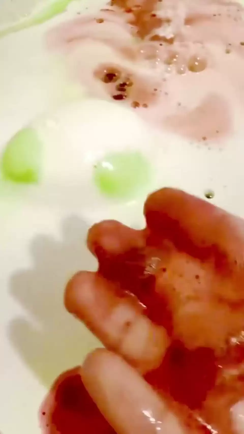 ҫ�������������ߺ����� ��˿ֱ�Կ�����Ѫˮ�ܶ���